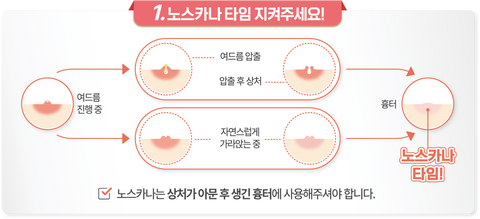 [✈️KOREA] HOT KOREAN DRUGSTORE ITEM Dong-A Noscarna Gel